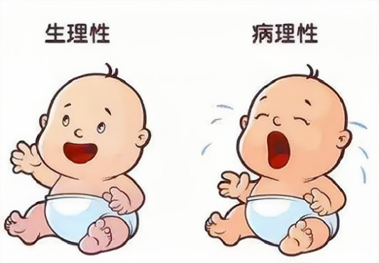 黃疸治療儀