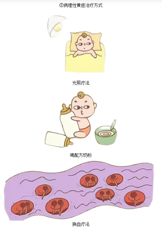 黃疸治療儀